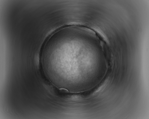 X0000093260204200710101505