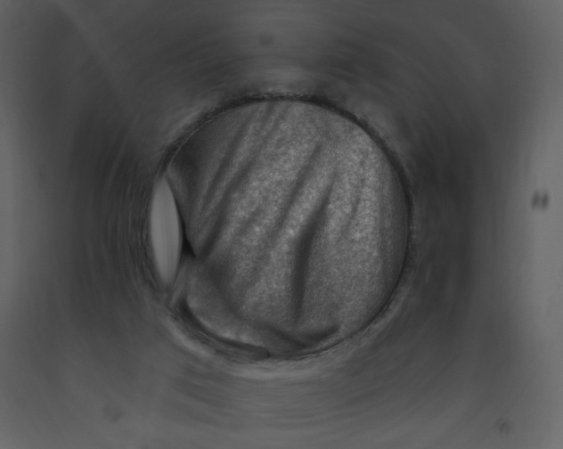 X0000093260017200710171459