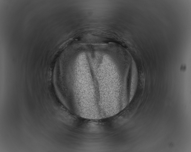 X0000093260657200710171450