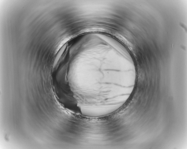 X0000093260945200710241330