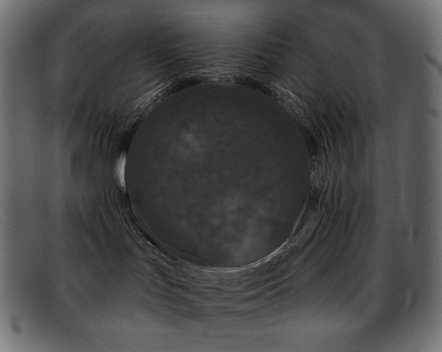 X0000093360047200710111502