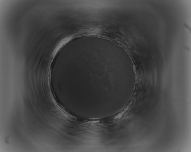 X0000093360054200710111502