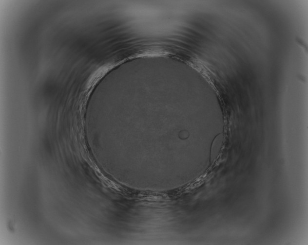 X0000093360337200710111458