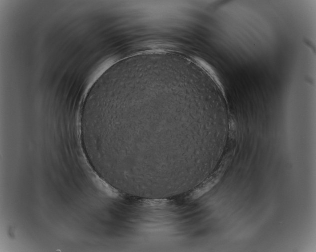 X0000093360859200710111453