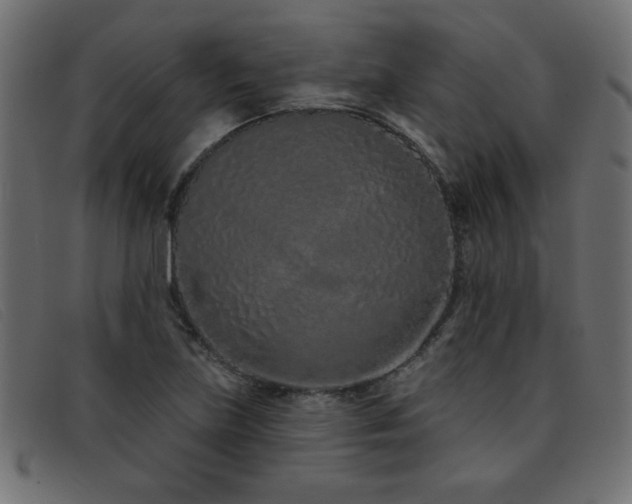 X0000093361219200710111448