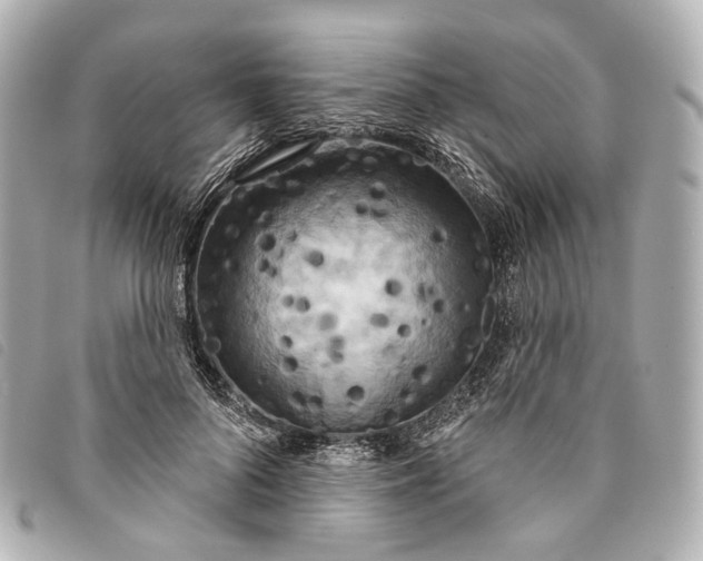 X0000093360696200710251131