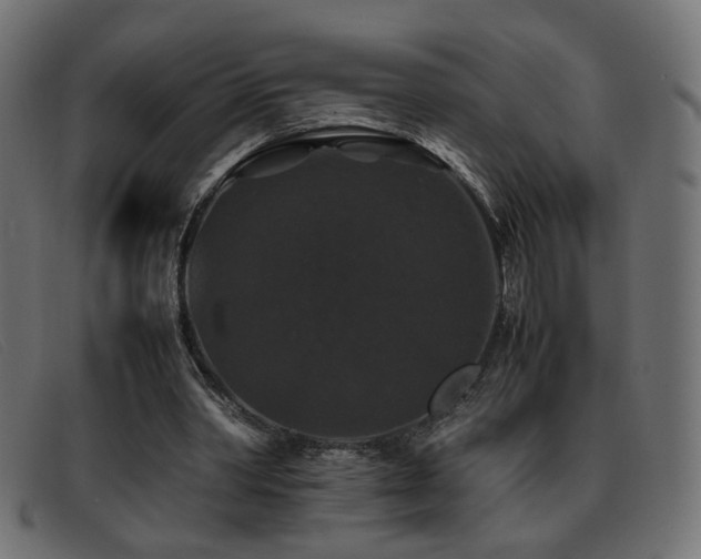 X0000093370390200710111440