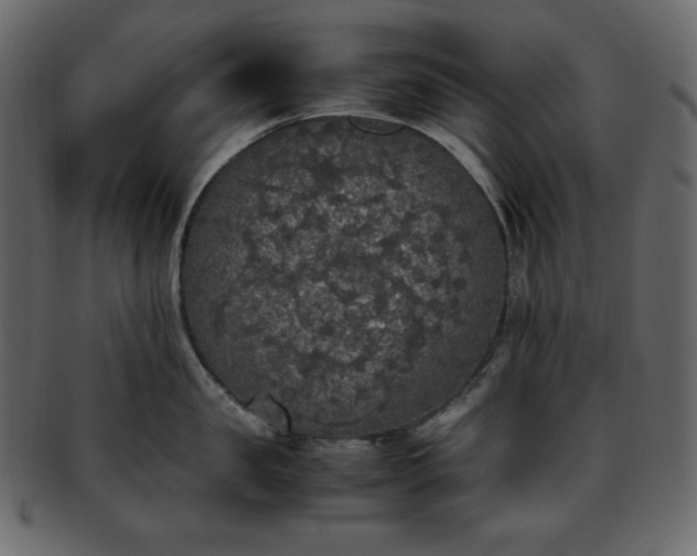 X0000093370957200710191113