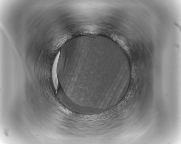 X0000093450017200711021123