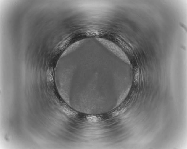 X0000093450616200711021115