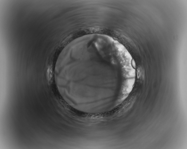 X0000093451011200711091508