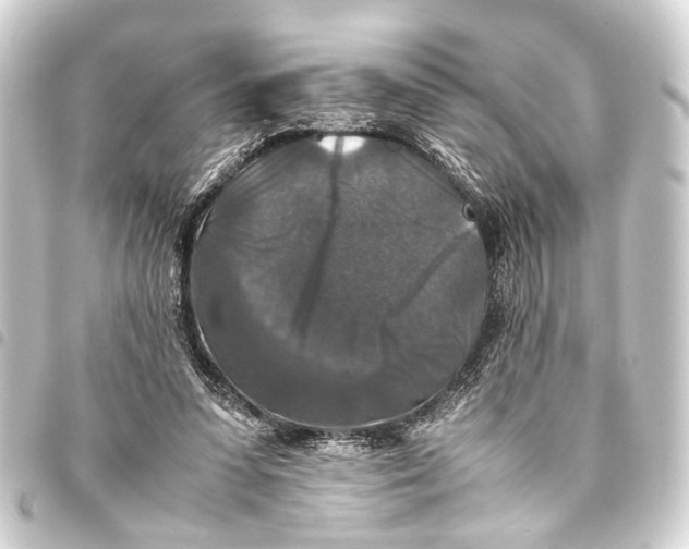 X0000093460303200711021140