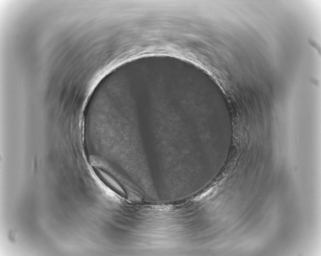 X0000093461519200711021124