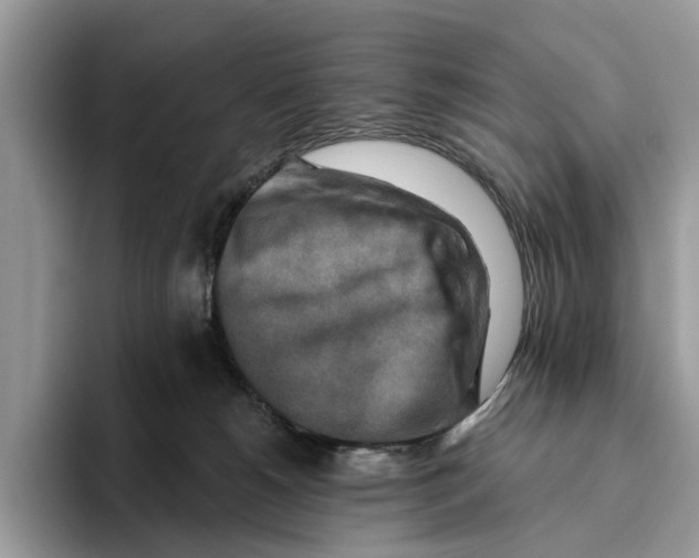 X0000093470180200711091614