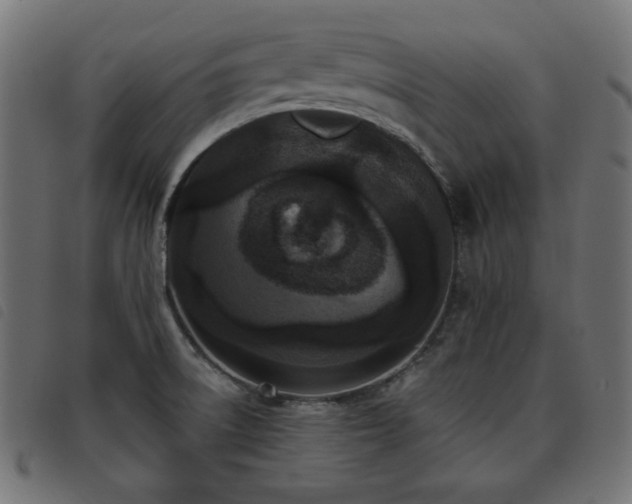 X0000093481522200710121435