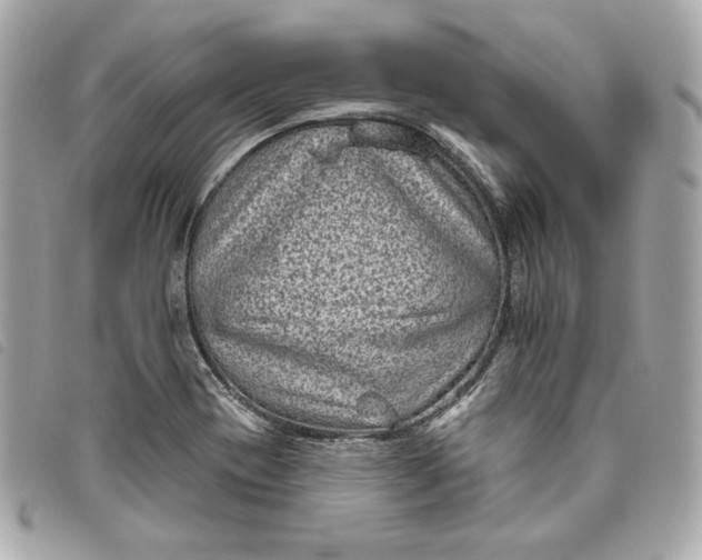 X0000093481417200710261030