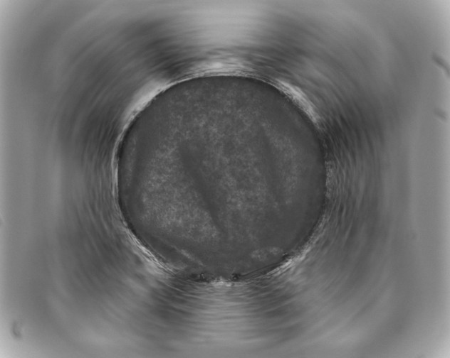 X0000093481419200710261030
