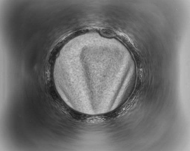 X0000093481159200711020928
