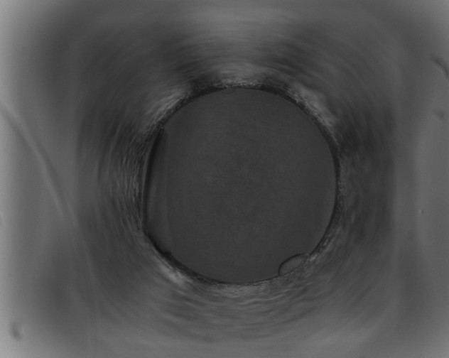 X0000093490017200710121516