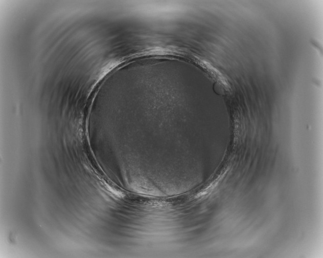 X0000093491170200710261111