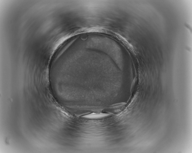 X0000093491174200710261111