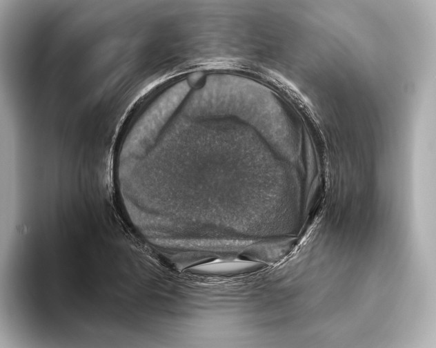 X0000093491174200711020946