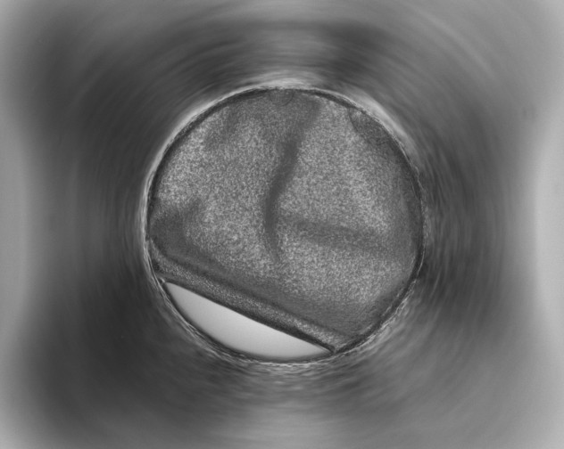 X0000093491240200711020945