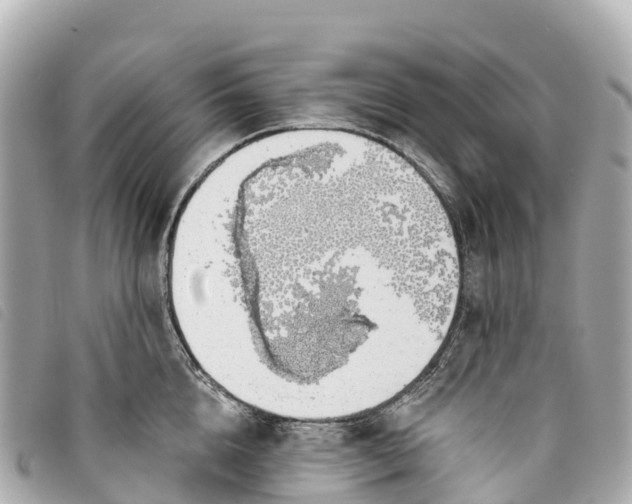 X0000093500856200710261136