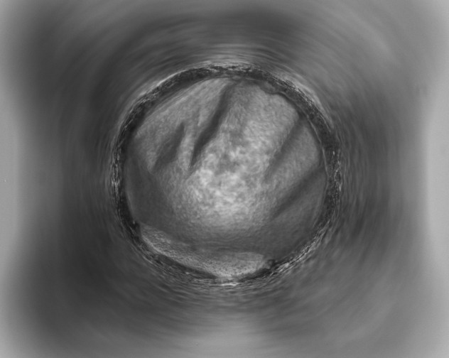 X0000093500920200711021007