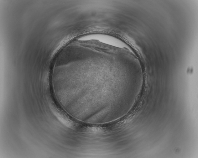 X0000093510250200710261204