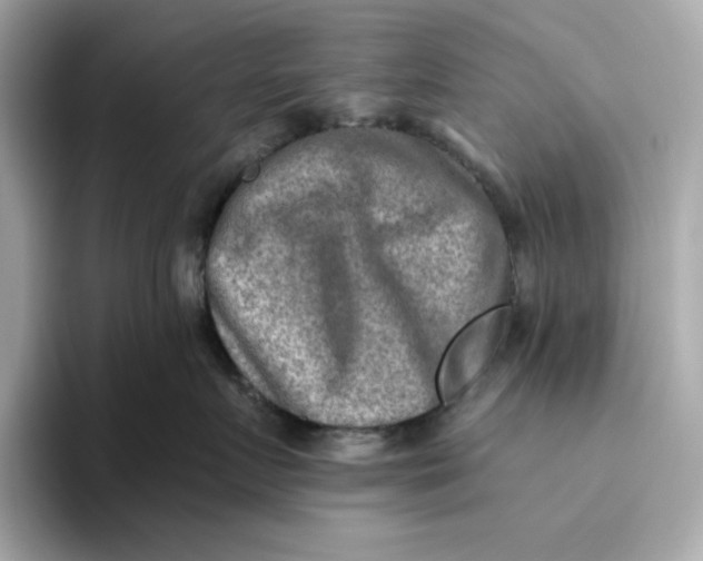 X0000093510719200711021028