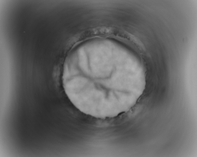 X0000093510192200711091728