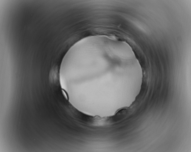 X0000093520143200711091746