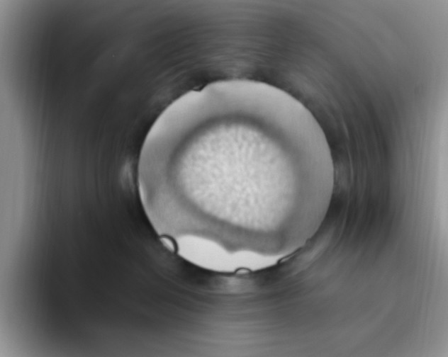 X0000093520286200711091745