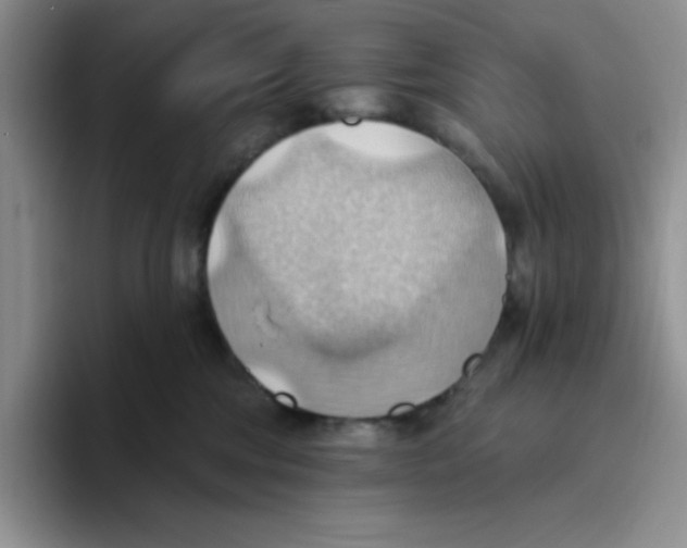 X0000093520330200711091744