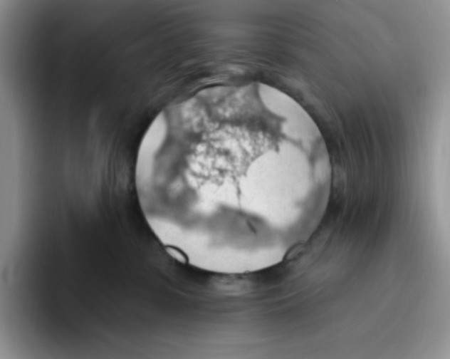 X0000093520331200711091744