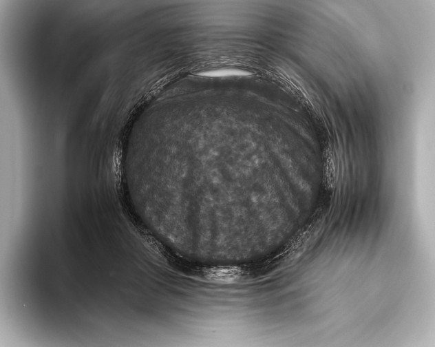 X0000093530410200711021314