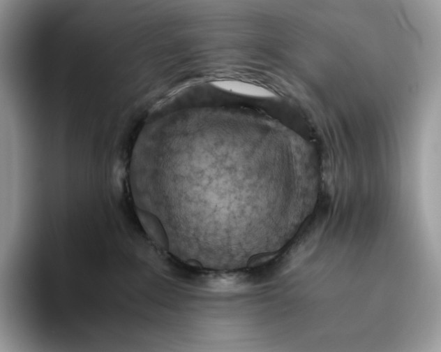 X0000093530235200711091803