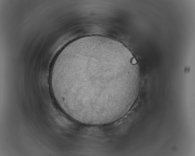 X0000093560146200710151114
