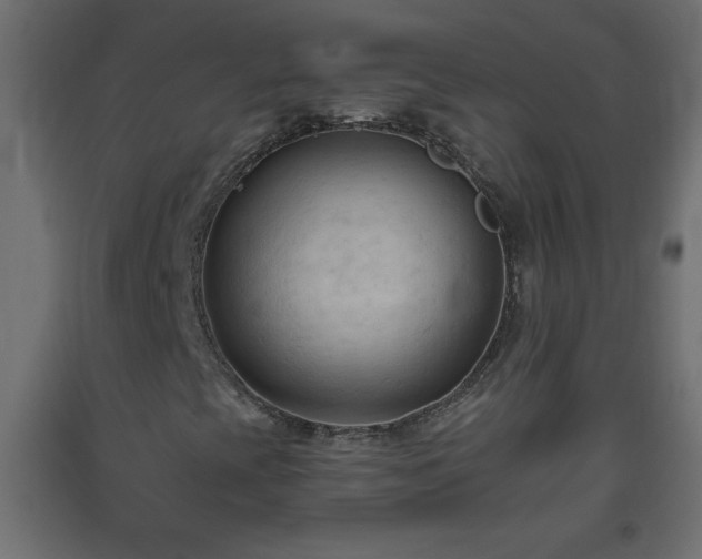 X0000093561393200710151058