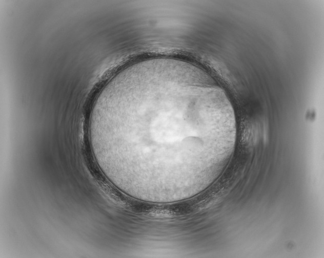 X0000093560685200711051038