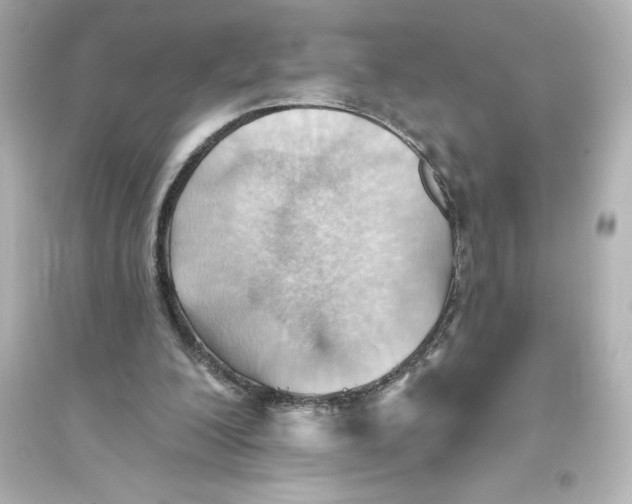 X0000093560200200711121022