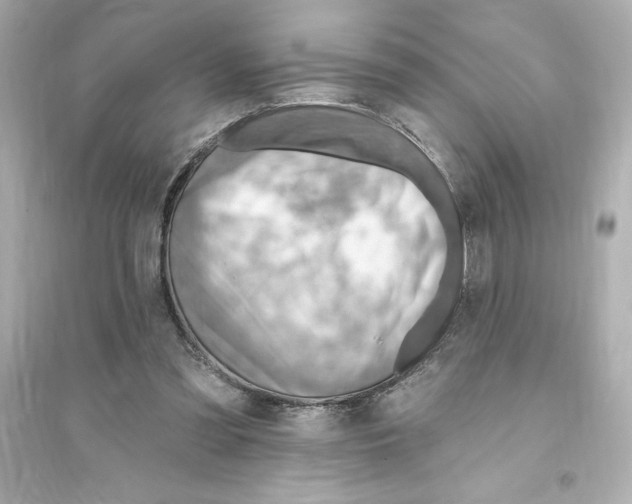 X0000093560301200711121020