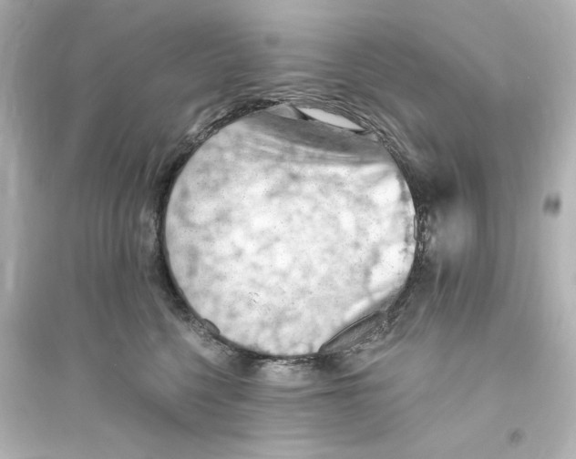X0000093560568200711121017