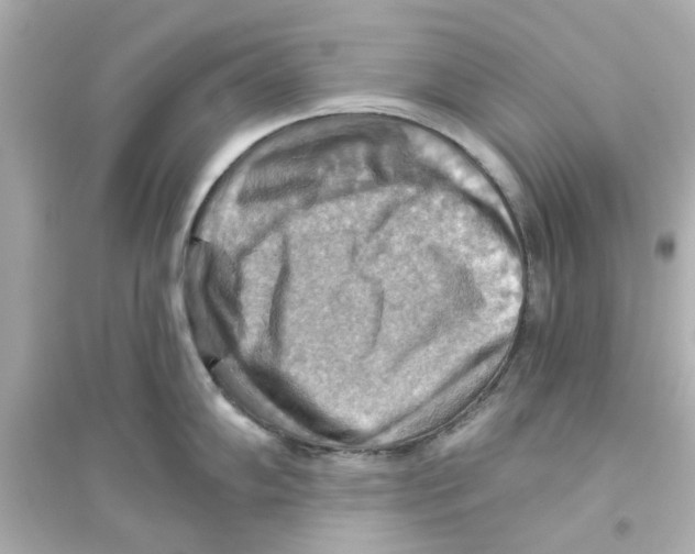X0000093561102200711121008