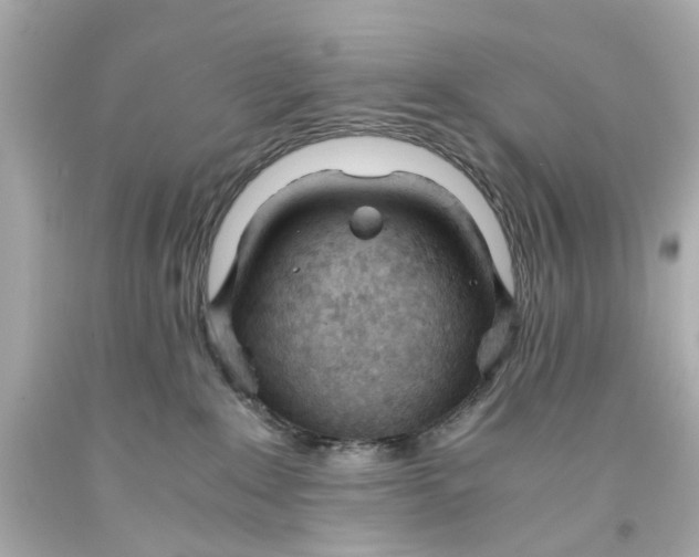 X0000093570235200711051104