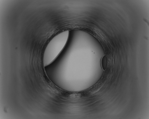 X0000093580700200710150958