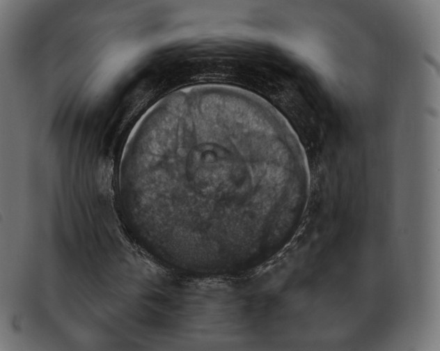 X0000093580146200710151151