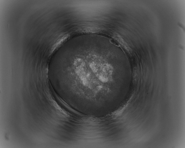 X0000093580585200710151146