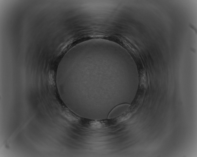 X0000093580616200710151146